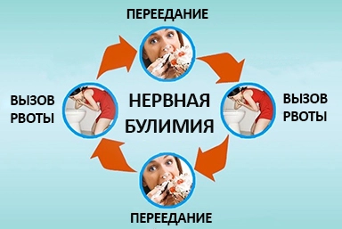 Лечение булимии в Холмской